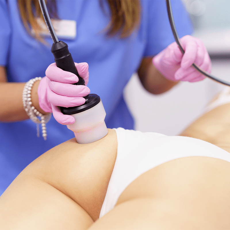Woman is receiving a Radio Frequency Skin Tightening treatment