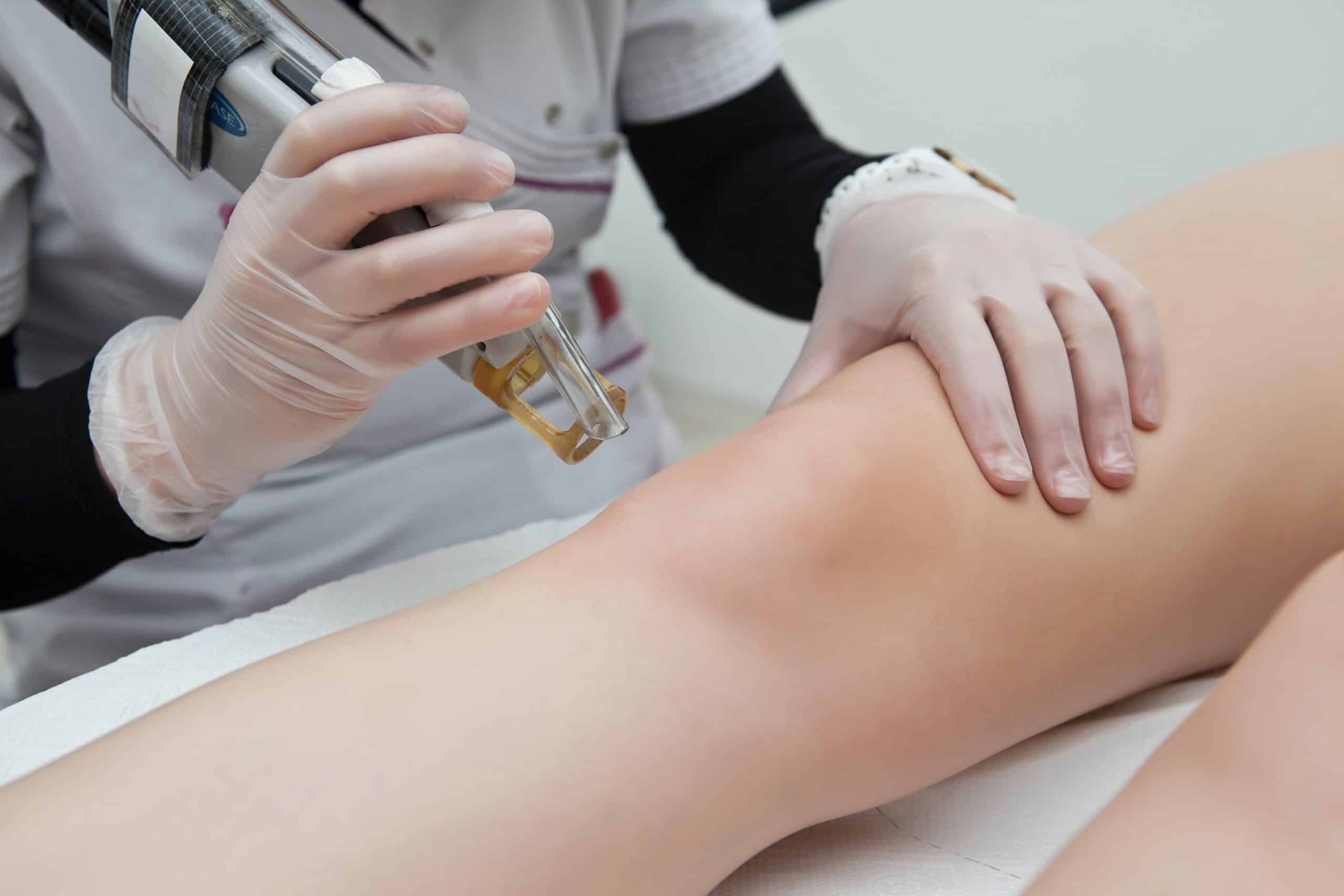 Getting to know more about hair laser removal.