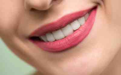 Five Natural Methods for At-Home Tooth Whitening
