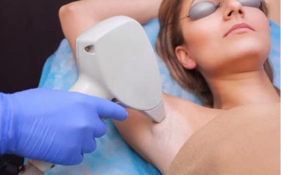 Painful Laser Hair Removal